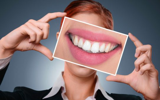 How Teeth Whitening Kits Work