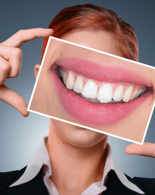 How Teeth Whitening Kits Work